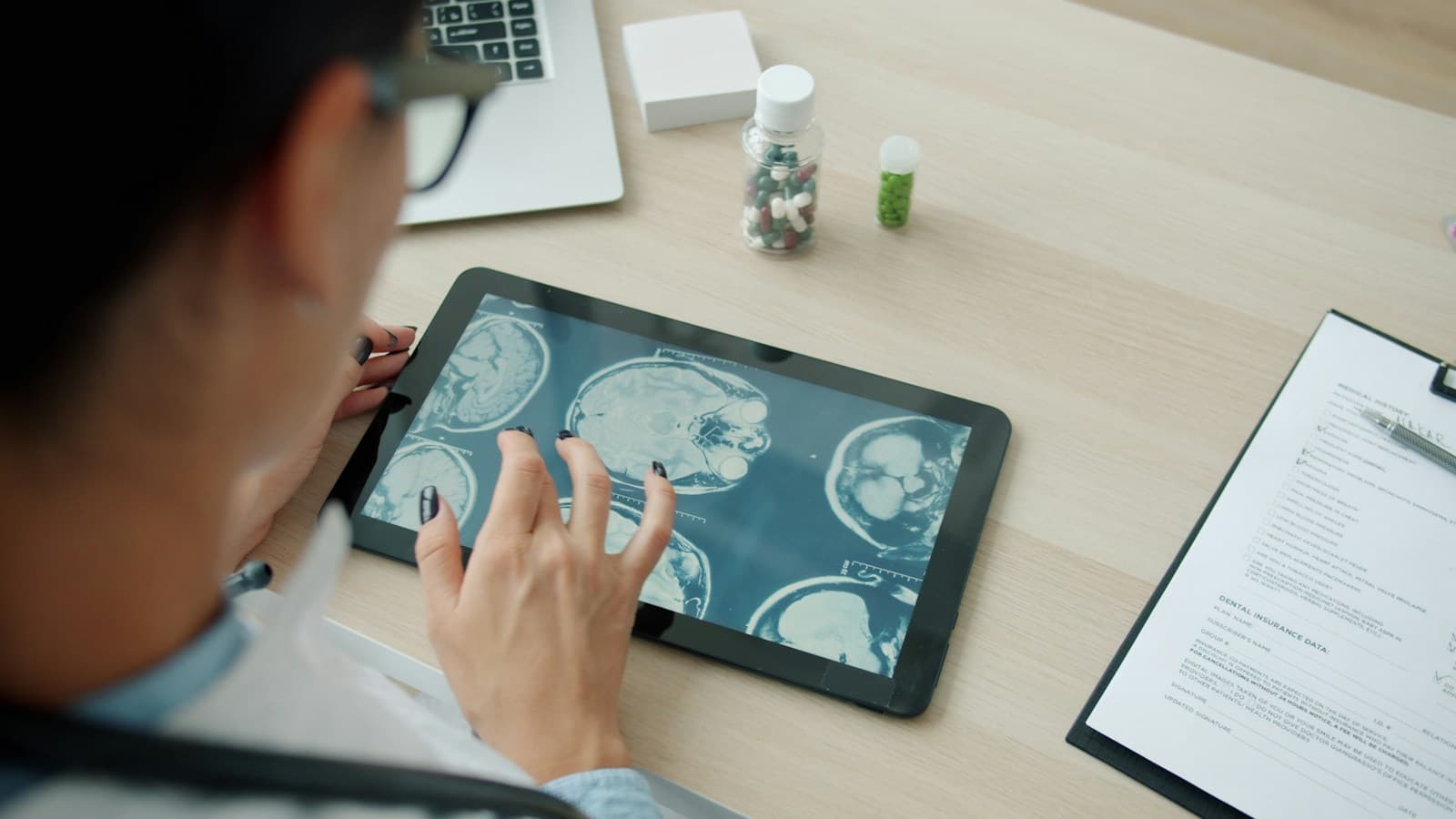 A clinician reviewing brain scans on a tablet